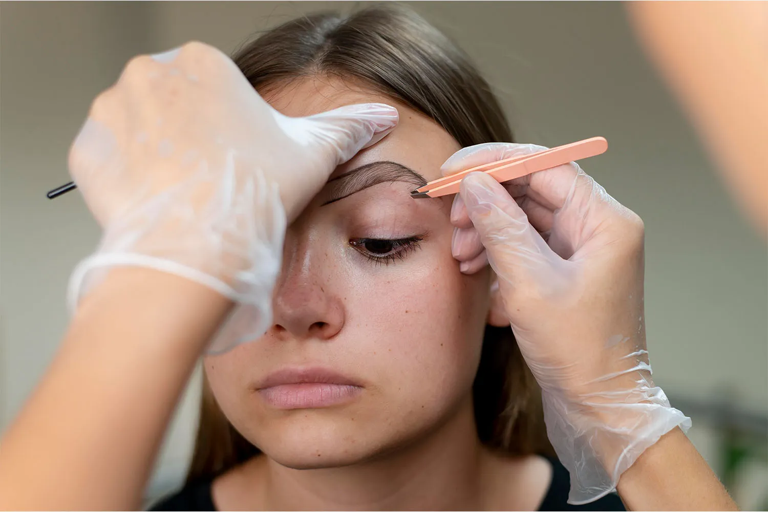 Eyebrow transplantation 1