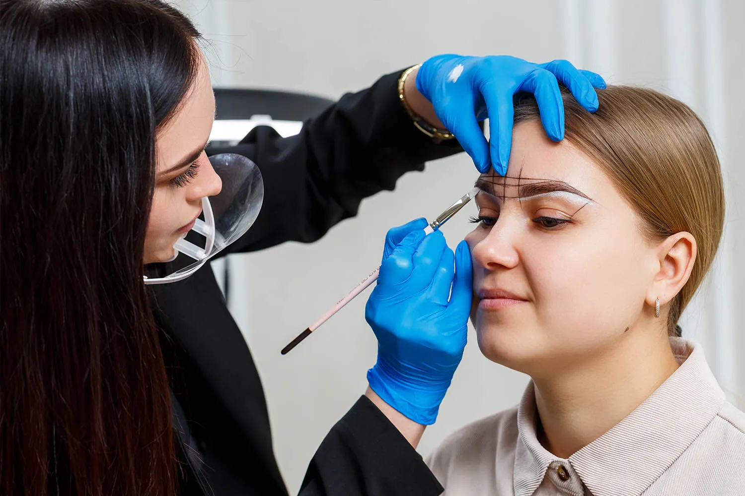 Eyebrow transplantation 3